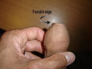 Foreskin piercing 1