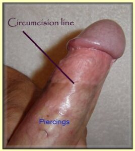 restored foreskin pull