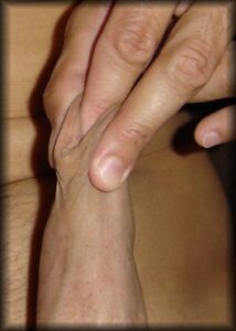 foreskin stretching squeeze