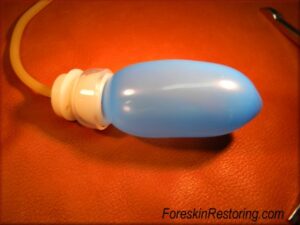 Foreskin restoring balloon method 66
